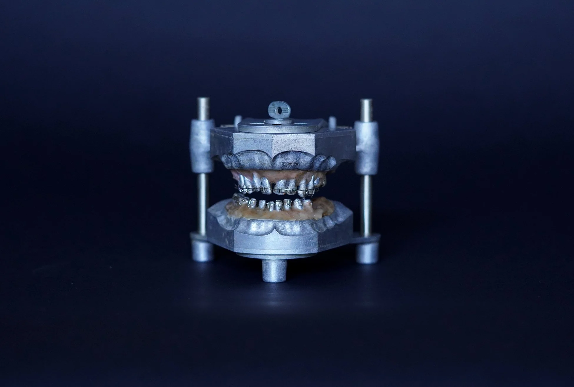 Shika×TOKYOGUNS CICAGO 1940's Orthodontic Teeth Set on Articulator Stand — AGENT GALLERY
